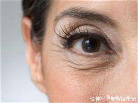 人老眼先老,2个护眼妙招,坚持一个月,好处自动找上门!