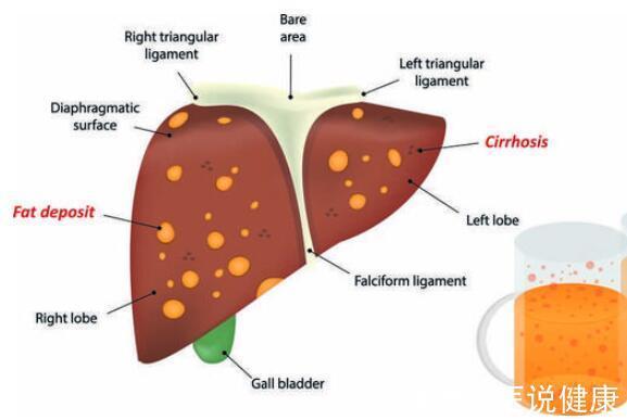 肝功能|这4种行为,正在悄悄耗尽你的“肝功能”,别后知后觉!