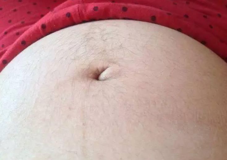 准妈妈|准妈妈肚皮被“盯上了”，孕肚的几个特点，跟胎宝性别有关吗？