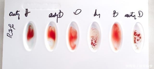 孕妇|孕妇是这个血型,你和孩子都有福气,但第一胎尽量别打掉