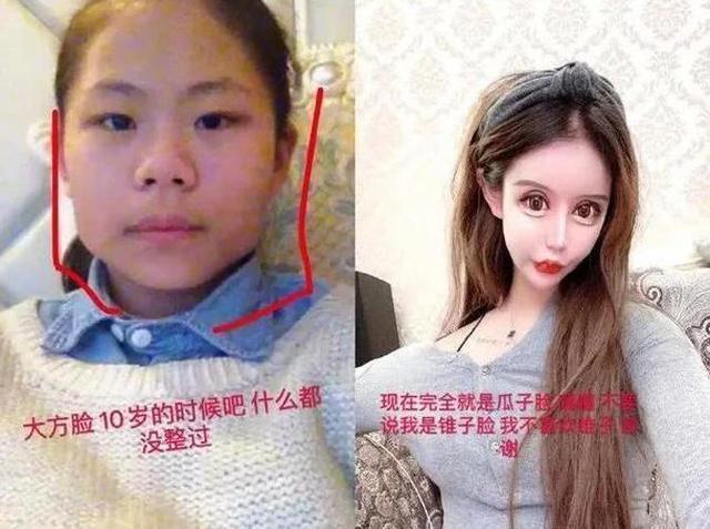 现状|花400多万做200次整容手术的“红粉宝宝”,现状让令人唏嘘