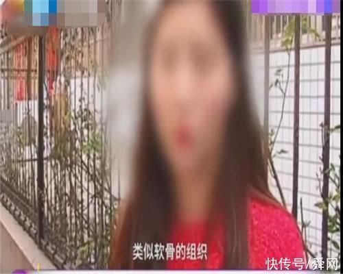 小到 女子整容失败遭破相，术后下眼睑少了一块，就像是腐烂的蚌壳肉……