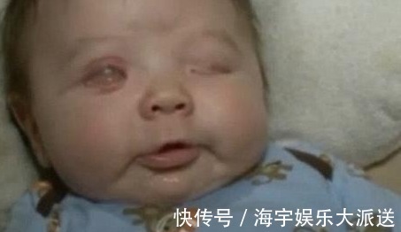 怀孕|刚出生孩子就没有眼睛,大夫检查过后,训斥母亲在怀孕时吃了此物