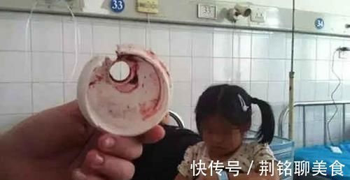 安全意识|妈妈送的生日礼物,差点致使5岁女童被“割掉舌头”