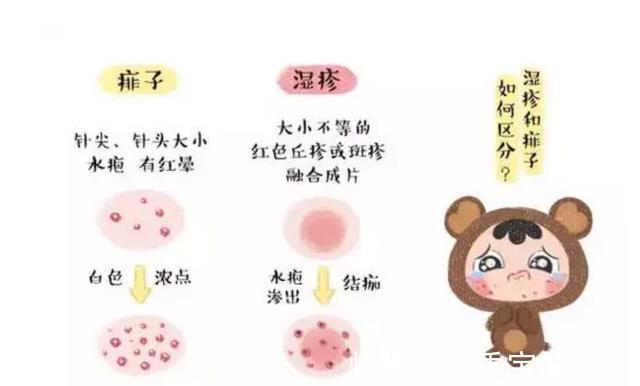 晒伤|夏季家长如何给宝宝护肤,正确护理可以让宝宝远离皮肤问题