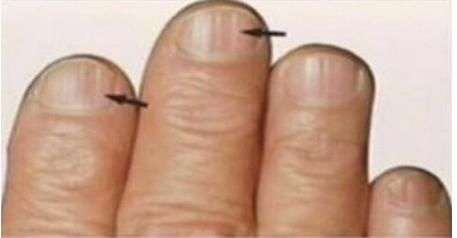 下降|肝不好，脚先知！若脚上出现5种“异常”，说明你的肝越来越差