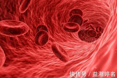 血管健康|颈动脉斑块怎么防治？呵护血管健康，3个健康常识，一个也不能少