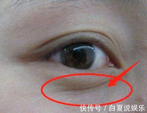 黄褐斑|子宫不好的女人，脸上会有4个“呼救”，要留意