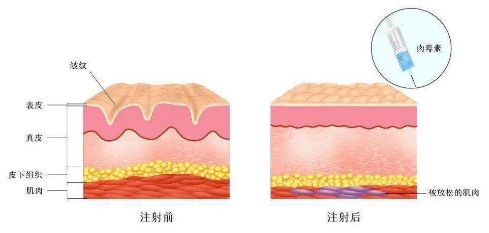 眼科医院|春节前这波操作，让TA刮目相看！