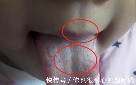 脾胃|孩子积食都是惯出来的,这三件事是积食“加速器”,劝告父母少做