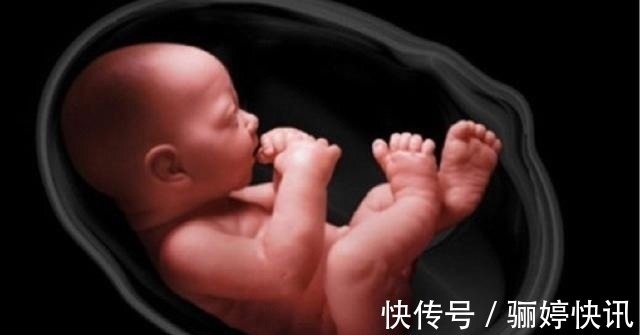 孕期|女性在孕期做这个动作,就会造成胎儿脐带绕颈,是真的吗