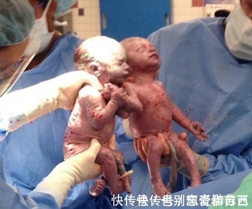 抢救|产妇抱着刚断气的新生儿不撒手, 嚎啕大哭, 突然感觉不对劲!