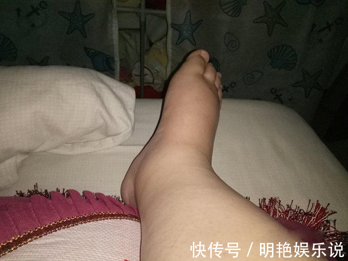 起生|“生剖”是什么体验?抗麻体质剖腹产生双胞胎,痛得直哆嗦