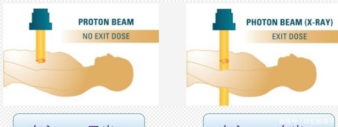 质子治疗让6岁男孩重回正常生活