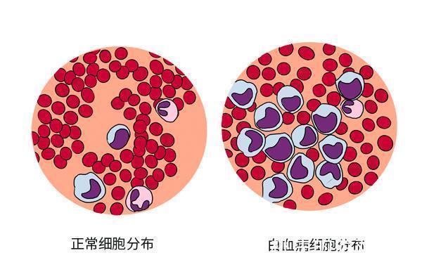治癌|中医治癌的3大误区，很多人深信不疑，真相在这里，切勿轻信