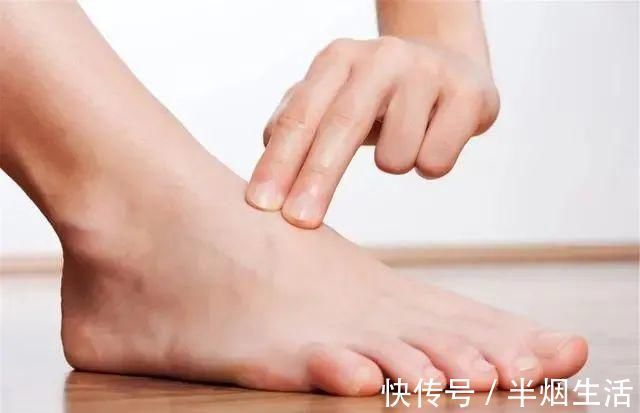 食物|血脂超标的人,鸡蛋可以吃,但这几类食物,请停止食用,切莫贪嘴