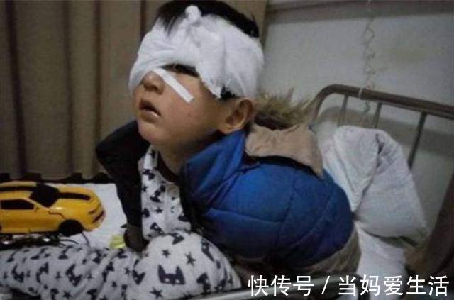 包装袋|别让孩子拿它当“玩具”,小心眼球“被融”,家里有的抓紧仍