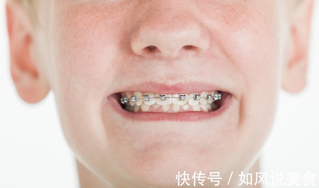 正畸|儿童做牙齿矫正三个最佳时间家长要牢记,矫治越早干预效果越好