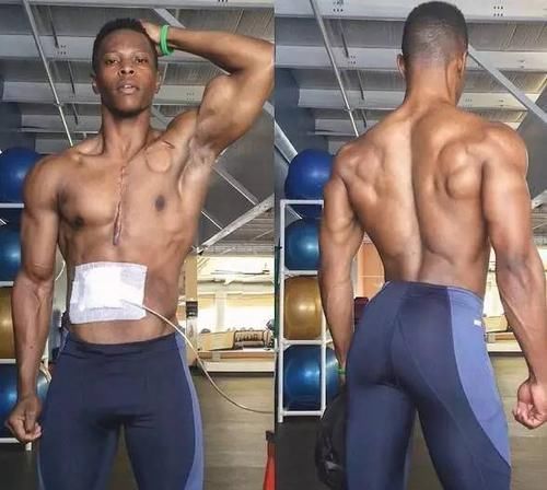 他没有心脏却仍坚持健身,美国27岁小伙感动全球