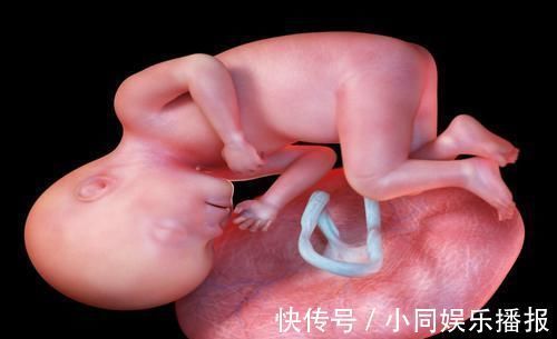 葡萄|孕晚期别这样睡觉,不仅胎儿易缺氧,还可能导致脐带绕颈