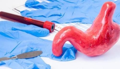 胃酸总是反反复复发作，4种原因占大头，万万不要太晚发现！