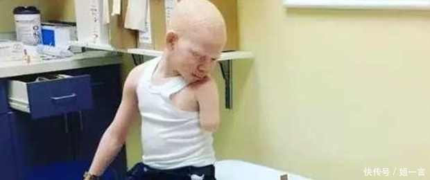 非洲“唐僧肉”,血液比黄金还贵,警察只能24小时守护他们