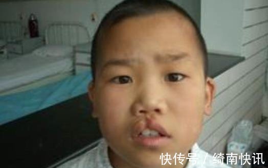 十月怀胎|孕妇十月怀胎,剖腹产2小时竟生出了“怪胎”,医生恭喜你