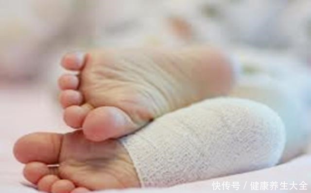 鞋底|5岁女宝双脚变形,只因长期穿这鞋,选鞋“雷坑”很多妈妈还在犯!