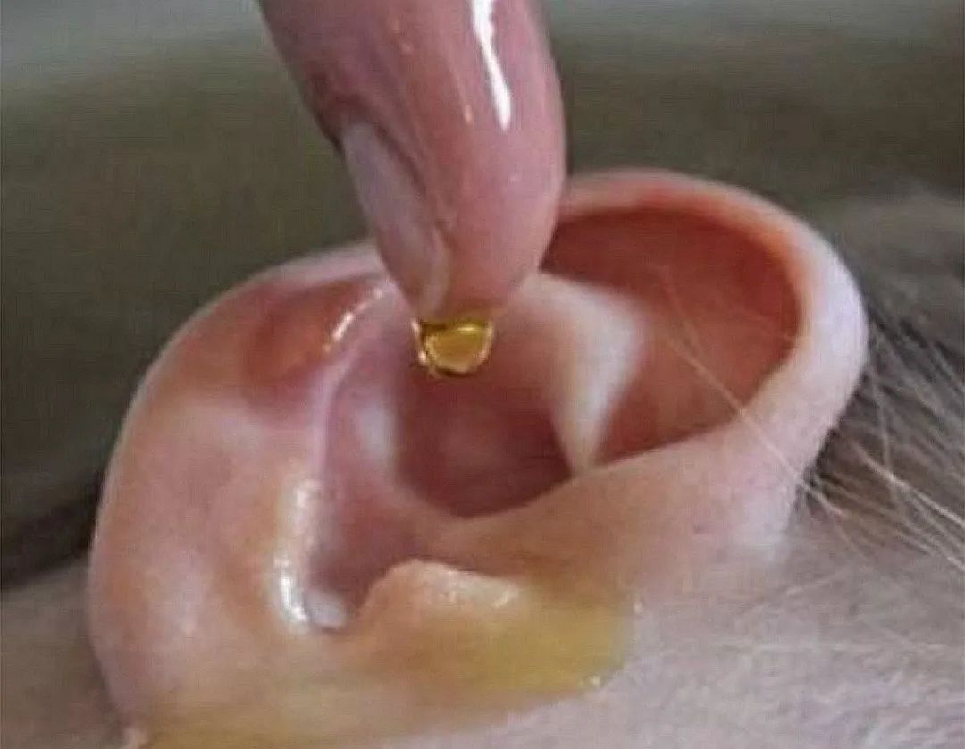 液体|娃耳朵进虫子,妈妈果断地处理方式救了孩子的听力,连医生都夸赞