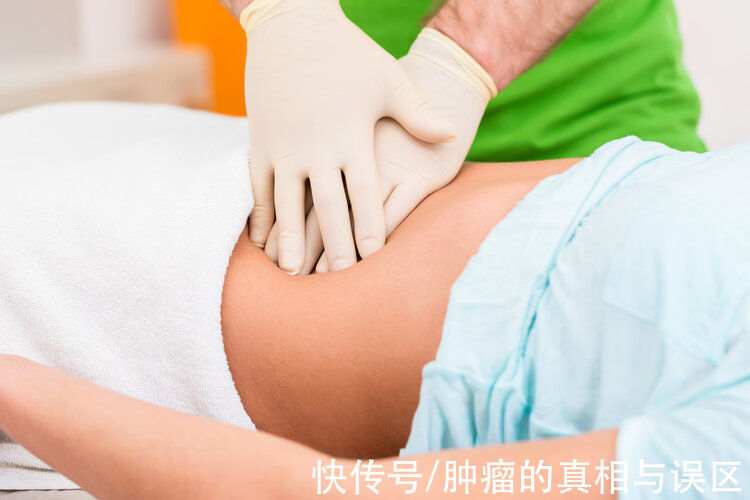 患者|失去肛门是种怎样的体验？我国“造口人”超百万，生存困境谁懂？