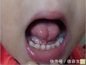 医院|4岁儿子还学不会说话,妈妈送去医院检查,张开嘴时把医生吓坏了