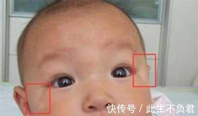 癥狀|孩子出現這5個癥狀, 就是肚子里長“蛔蟲”了！