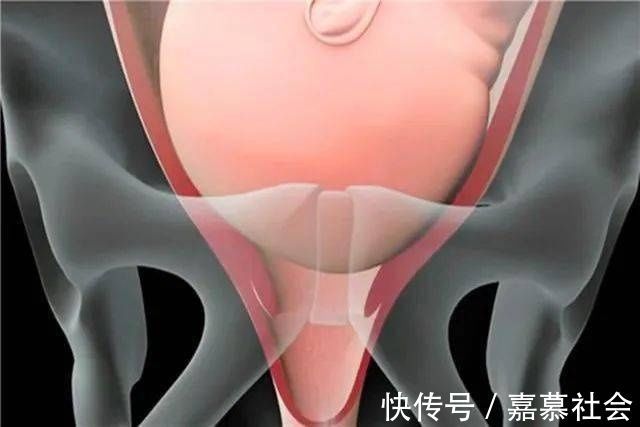 产妇|产道那么小胎儿到底咋出来的?看完这组图泪目了,女人太不容易了