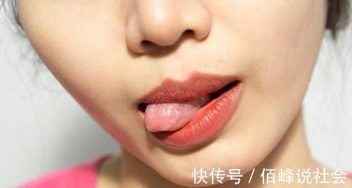 女性|女性有没有妇科疾病,看看“嘴”或许就知道,不妨自测一下