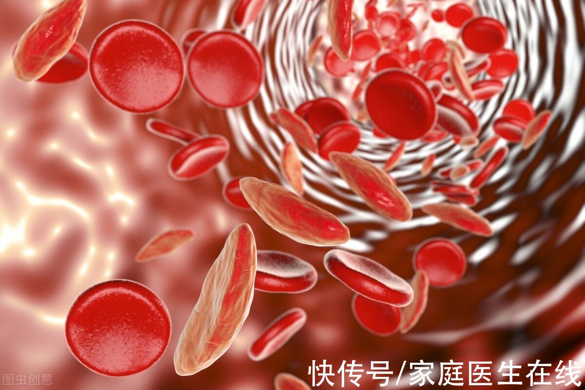 补铁|贫血就是补铁？不止缺铁性贫血这一种，不同类型各有补营养妙招