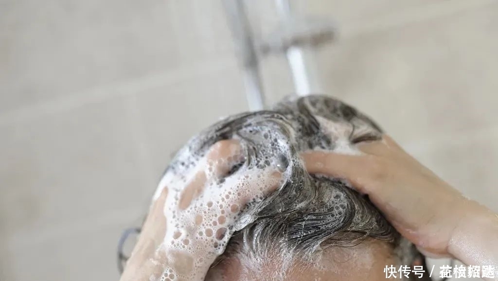 头皮|这4种错误的洗头方式,让你的头发越掉越多!