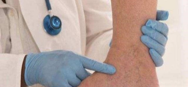 牛奶|糖尿病人喝酸奶、牛奶,升血糖还是降血糖?或许很多人做错了