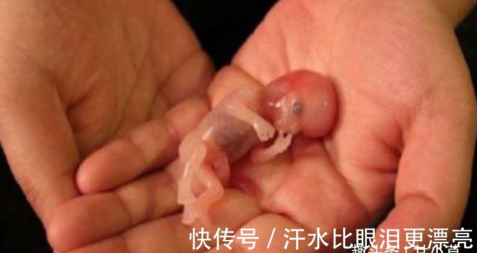 人流|人流那么多,那些被准妈妈流产的孩子都去哪里了?