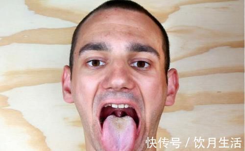 寒湿|湿气重，舌头知？提醒：舌头出现2个现象，暗示体内湿气还不小
