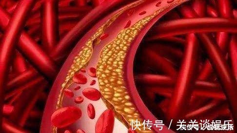 甘油三酯|三位院士声明开水里加一勺，连喝15天，血管通透明亮，血脂悄悄