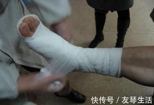 接骨续筋|骨折别再喝骨头汤了,送你三副“接骨良方”,快收好备用