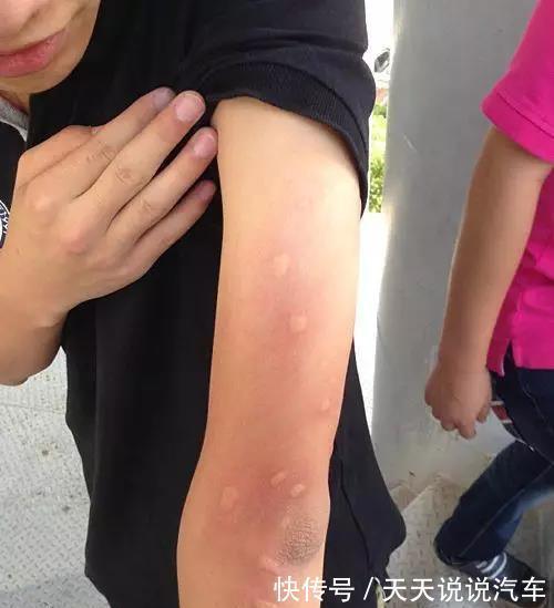 |搞笑段子:有哪些段子,能让人笑到肾抽筋?第100辑