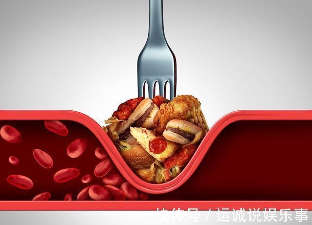 原发性|70%的人血脂异常,医生:高血脂可以吃回去,这3个方法快告诉家人