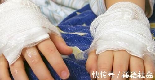 急救|4岁宝宝掉入170度油锅,奶奶3步救下孩子,医生:急救措施很专业
