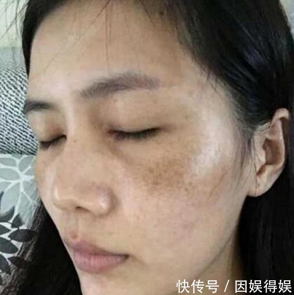 “小苏打”这样用,7天美白嫩肤,20天明显淡斑,色斑妹子不愁了
