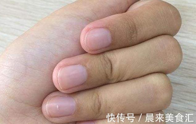 缺铁|儿童身高标准公布,你家孩子是否达标?若达标,恭喜长大不会矮