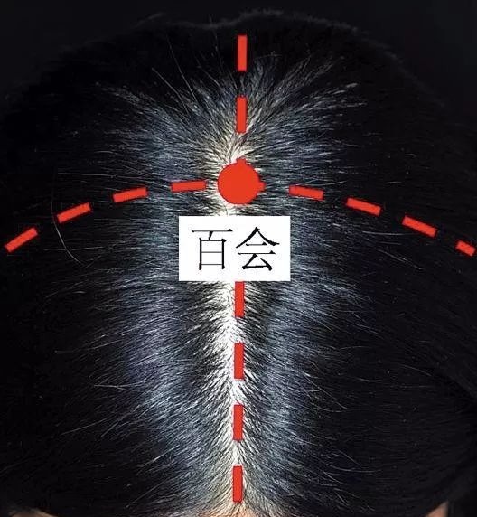 百会穴|头顶上有个“祛湿穴”,每天一按,排湿气,健脾胃,失眠改善了