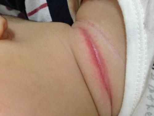 湿巾|三个月的宝宝“淹脖子”,原来是它们惹的祸,宝妈们可别再用了