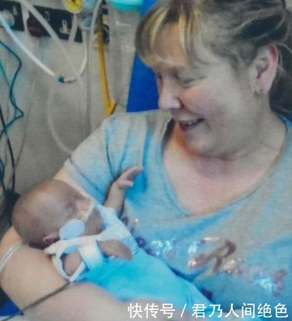 女子|女子生的孩子只有手掌大小,本以为活不久,半年过后,父母乐坏了