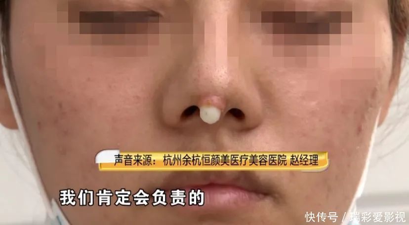 怀孕 漂亮姑娘刚怀孕,鼻尖出现神秘白色物体!婆婆追问下,她瞒不住了……